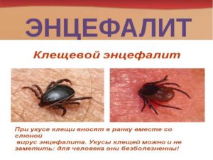 Клещевой вирусный энцефалит.